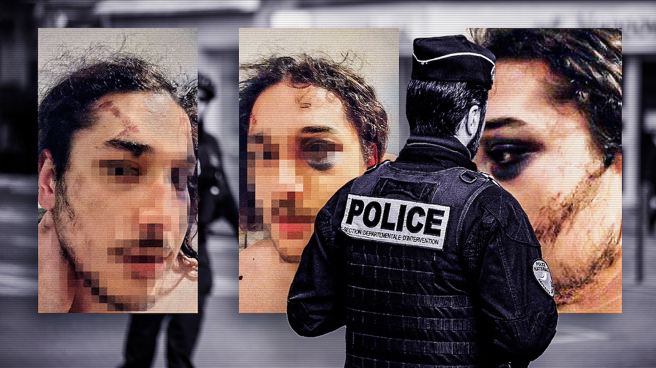 Adil, victime de coups de taser, tabassages et racisme policier
