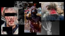 Police, Violence policière, coups et blessures, bavure policière, Manifestation, paris, Lyon, Clermont-Ferrand, Marseille, gaz lacrymogène, lycéens, coups de matraque, canon à eau